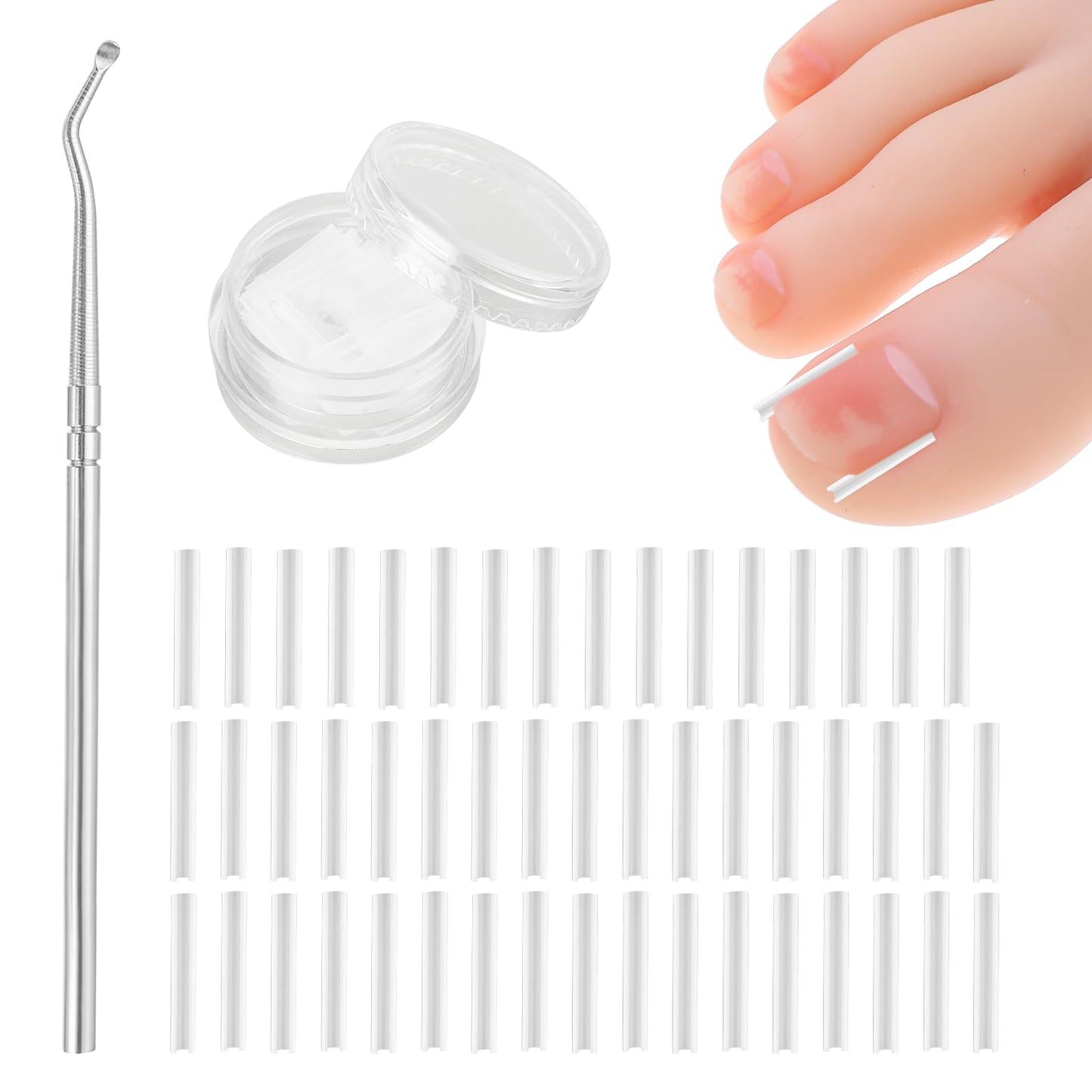 (50+1) Pcs Ingrown Toenail Treatment Corrector Set, Professional Pain-Free Ingrown Toenail Removal Kit with Toenail Lifter, Toenail Straightener Strip for Men Women, Easy Fixed Ingrown Toenail Tool