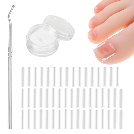 (50+1) Pcs Ingrown Toenail Treatment Corrector Set, Professional Pain-Free Ingrown Toenail Removal Kit with Toenail Lifter, Toenail Straightener Strip for Men Women, Easy Fixed Ingrown Toenail Tool